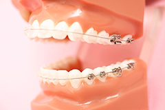 歯列矯正イメージ2